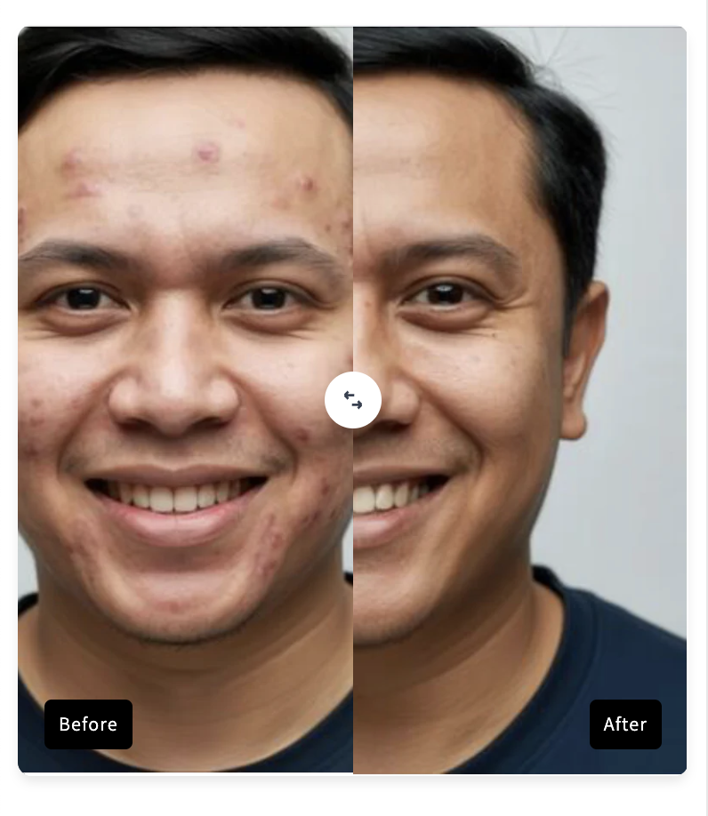 Before/After Comparison — Shopify Conversion snippet preview