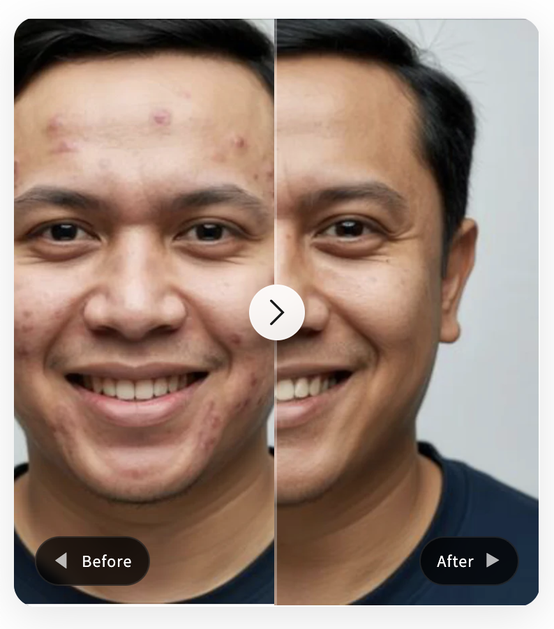 Glass Style style variation for Before/After Comparison